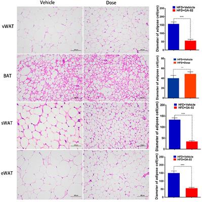 Creation of an Anti-Inflammatory, Leptin-Dependent Anti-Obesity Celastrol Mimic with Better Druggability